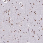 Anti-SEMA6B Antibody