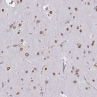 Immunohistochemical staining of human cerebral cortex shows high expression.