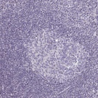 Anti-SEMA6B Antibody