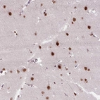 Anti-ZNF672 Antibody