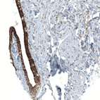 Anti-MXRA8 Antibody