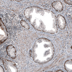 Anti-MXRA8 Antibody