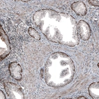 Immunohistochemical staining of human prostate shows moderate membranous positivity in basal cells.