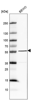 Western blot analysis in human cell line BEWO.