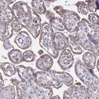 Immunohistochemical staining of human placenta shows moderate positivity in trophoblastic cells.