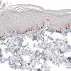 Anti-MLANA Antibody