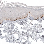 Immunohistochemical staining of human skin shows strong cytoplasmic positivity in melanocytes.