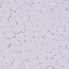 Immunohistochemical staining of human skeletal muscle shows no positivity in myocytes as expected.