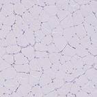 Immunohistochemical staining of human skeletal muscle shows no positivity in myocytes as expected.