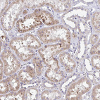 Anti-TMEM8C Antibody