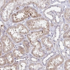 Immunohistochemical staining of human kidney shows weak cytoplasmic positivity in cells in tubules.