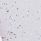 Anti-ZNF280C Antibody