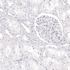 Immunohistochemical staining of human kidney shows no positivity as expected.