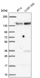 Western blot analysis in human cell line RT-4 and human cell line U-251 MG.