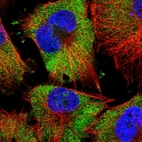 Immunofluorescent staining of human cell line U-251 MG shows localization to cytosol.