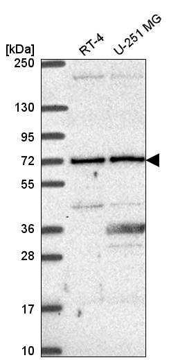 Anti-UTP6 Antibody