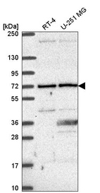 Anti-UTP6 Antibody