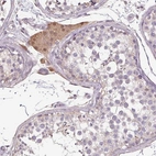 Anti-PRSS38 Antibody