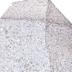 Immunohistochemical staining of human cervix shows no positivity in squamous epithelial cells as expected.