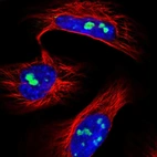 Immunofluorescent staining of human cell line U-2 OS shows localization to nucleoli.