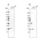 Anti-POLR2H Antibody