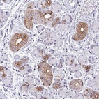 Anti-RGS16 Antibody