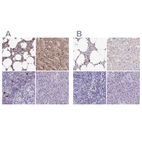 Immunohistochemical staining of human bone marrow, liver, lymph node and pancreas using Anti-CAT antibody HPA055838 (A) shows similar protein distribution across tissues to independent antibody HPA051282 (B).