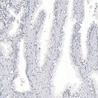 Anti-MLANA Antibody