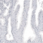 Immunohistochemical staining of human prostate shows no positivity in glandular cells as expected.