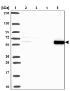 Anti-CAT Antibody