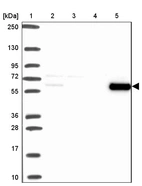 Lane 1: Marker [kDa] 250, 130, 95, 72, 55, 36, 28, 17, 10_br/_Lane 2: Human cell line RT-4_br/_Lane 3: Human cell line U-251 MG_br/_Lane 4: Human plasma_br/_Lane 5: Human Liver tissue
