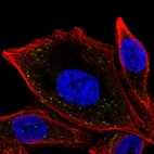 Immunofluorescent staining of human cell line PC-3 shows localization to vesicles.