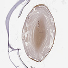 Anti-CRYBB3 Antibody