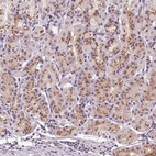 Anti-GOLPH3 Antibody