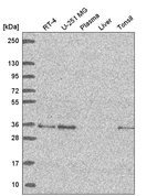 Western blot analysis in human cell line RT-4, human cell line U-251 MG, human plasma, human liver tissue and human tonsil tissue.