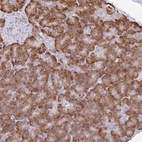 Anti-DOK4 Antibody