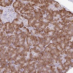 Anti-DOK4 Antibody