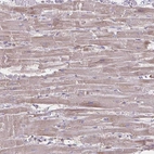 Anti-TIMMDC1 Antibody