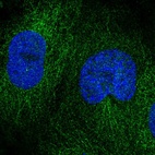 Anti-DOK4 Antibody