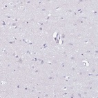 Immunohistochemical staining of human cerebral cortex shows low expression as expected.