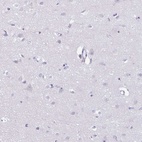 Anti-AZU1 Antibody