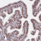 Anti-CREBBP Antibody