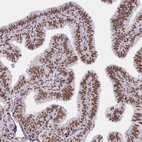 Immunohistochemical staining of human Fallopian tube shows strong nuclear positivity in glandular cells.