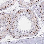 Immunohistochemical staining of human testis shows moderate to strong nuclear positivity in cells in seminiferous ducts.
