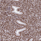 Immunohistochemical staining of human endometrium shows strong nuclear positivity in glandular cells and stromal cells.