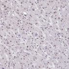 Immunohistochemical staining of human liver shows very weak nuclear positivity in hepatocytes as expected.