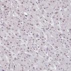 Immunohistochemical staining of human liver shows very weak nuclear positivity in hepatocytes as expected.
