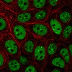 Immunofluorescent staining of human cell line MCF7 shows localization to nucleoplasm & nuclear bodies.