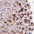 Anti-SP140L Antibody