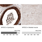 Anti-WFDC2 Antibody